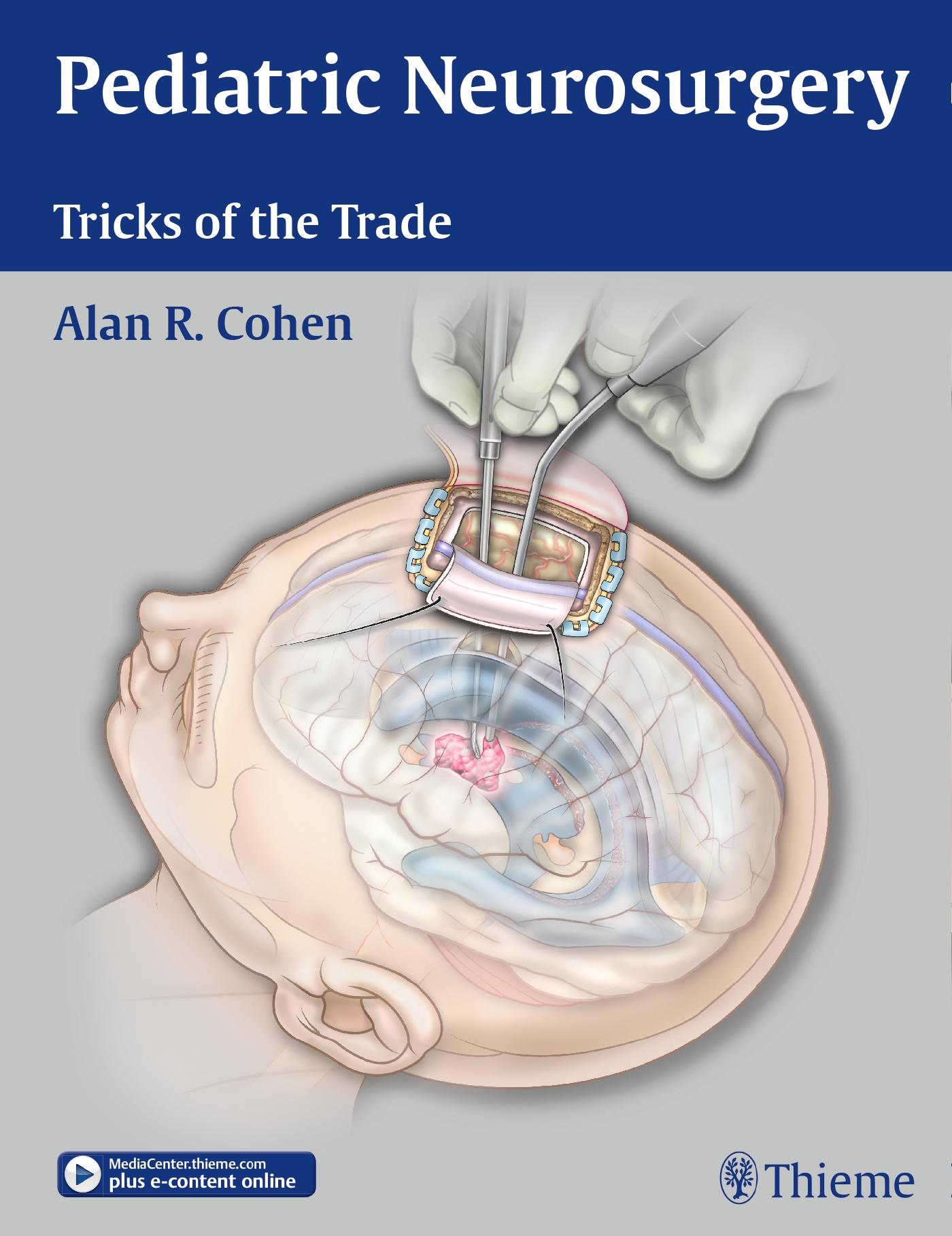 Vorderes Coverbild Pediatric Neurosurgery: Tricks of the Trade