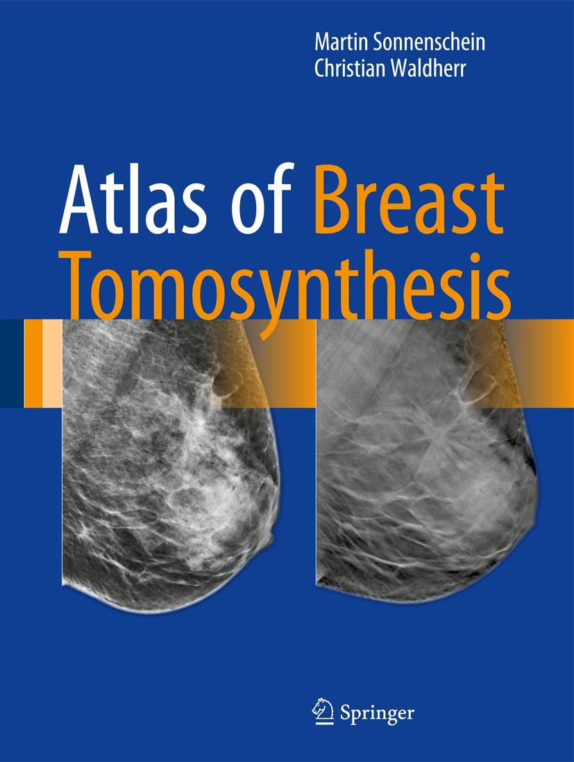 Vorderes Coverbild Atlas of Breast Tomosynthesis