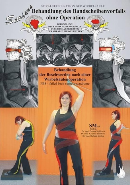 Vorderes Coverbild Behandlung des Bandscheibenvorfalls ohne Operation