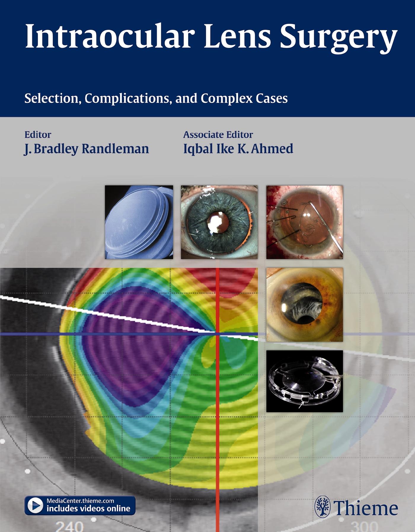 Vorderes Coverbild Intraocular Lens Surgery