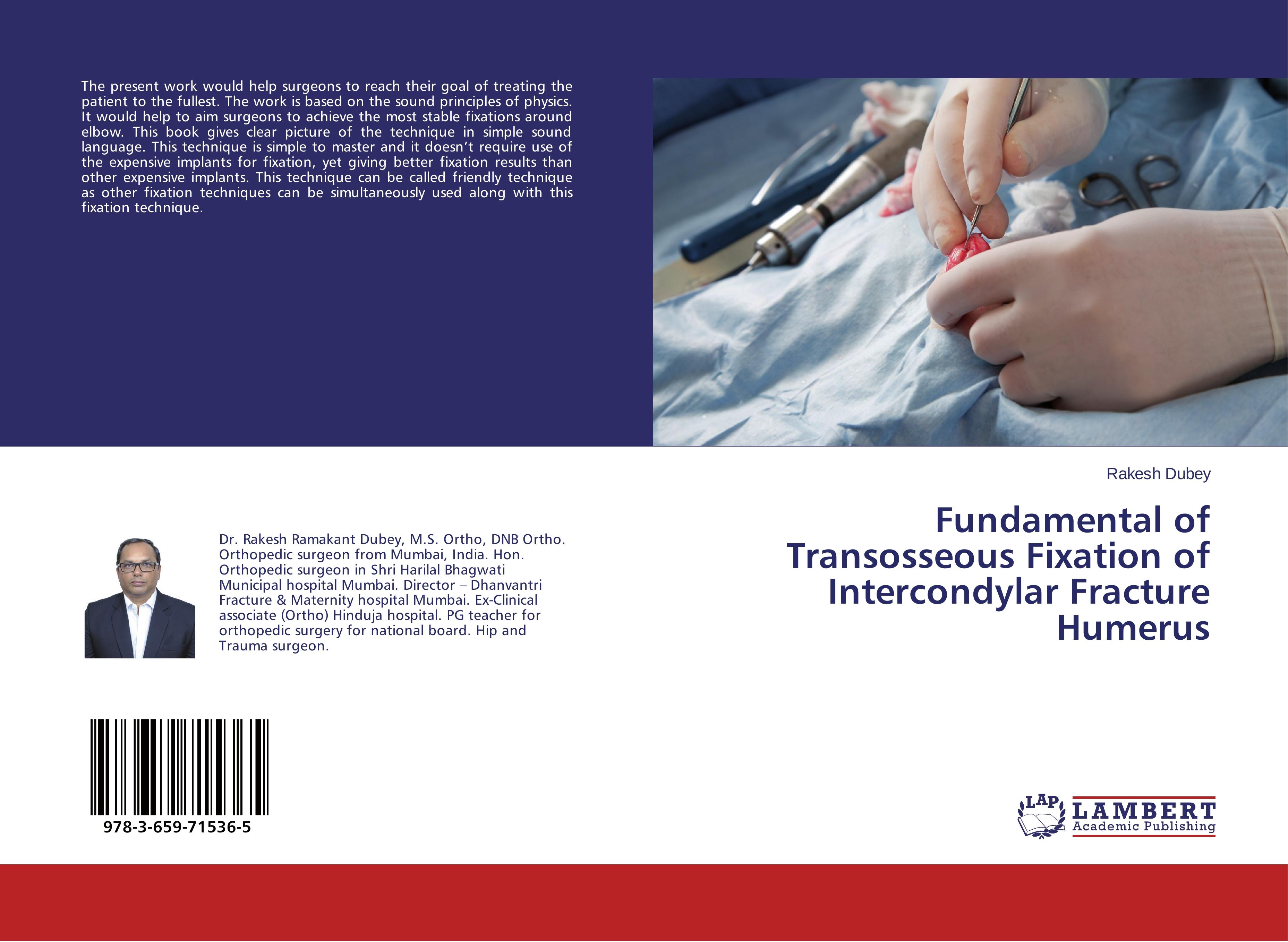 Vorderes Coverbild Fundamental of Transosseous Fixation of Intercondylar Fracture Humerus