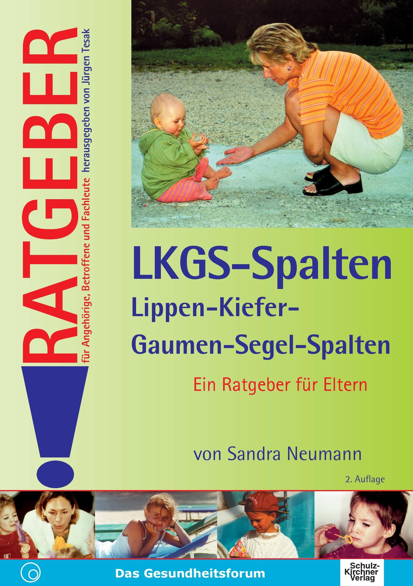 Vorderes Coverbild Lippen-Kiefer-Gaumen-Segelspalten (LKGS)