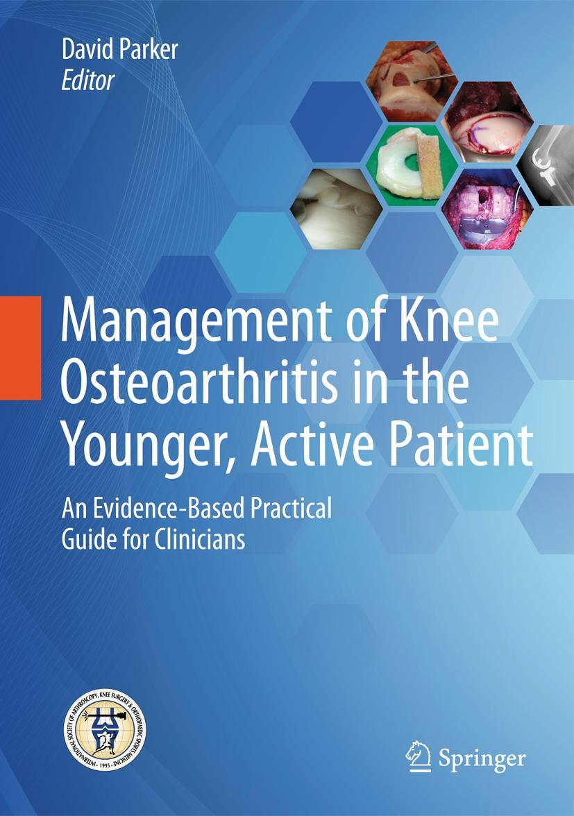 Vorderes Coverbild Management of Knee Osteoarthritis in the Younger, Active Patient