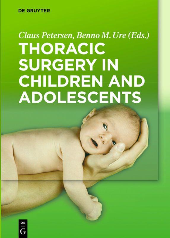 Vorderes Coverbild Thoracic Surgery in Children and Adolescents