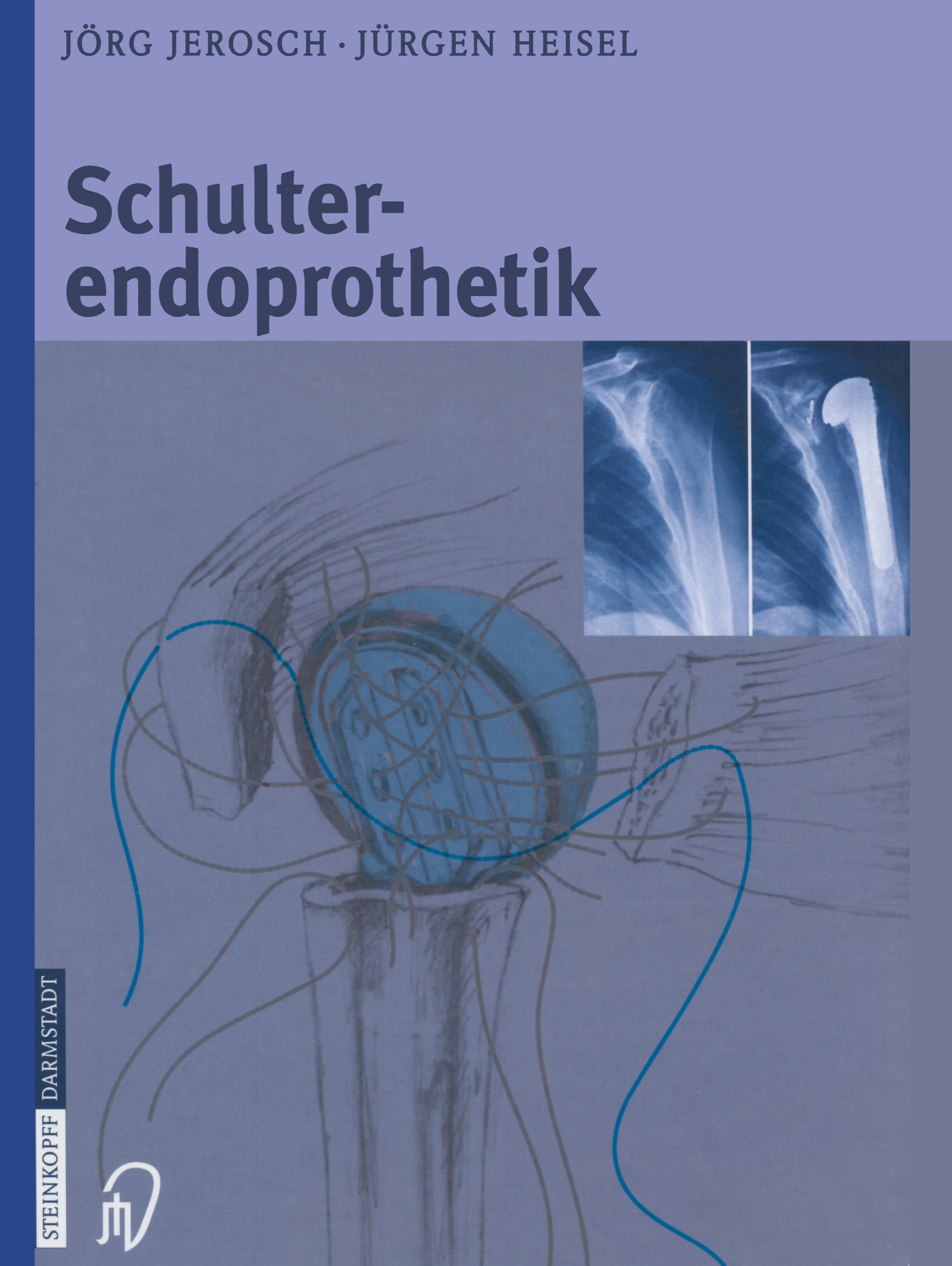Vorderes Coverbild Schulterendoprothetik