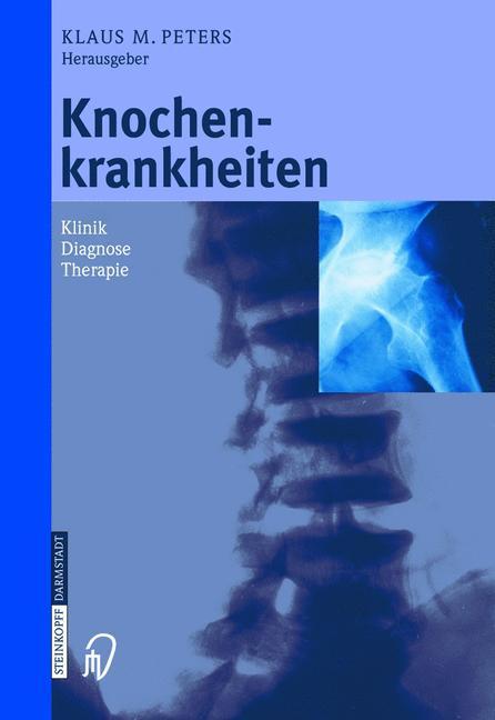 Beispielinhalt (Bild) Knochenkrankheiten
