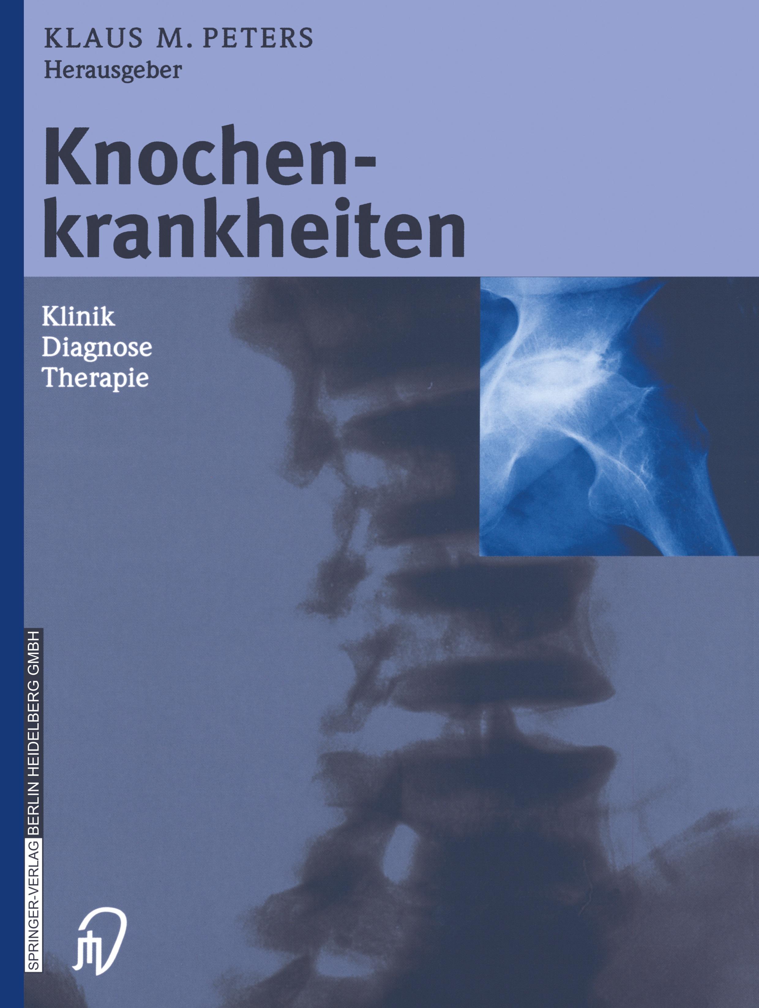 Vorderes Coverbild Knochenkrankheiten