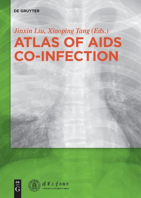 Vorderes Coverbild Atlas of AIDS Co-infection