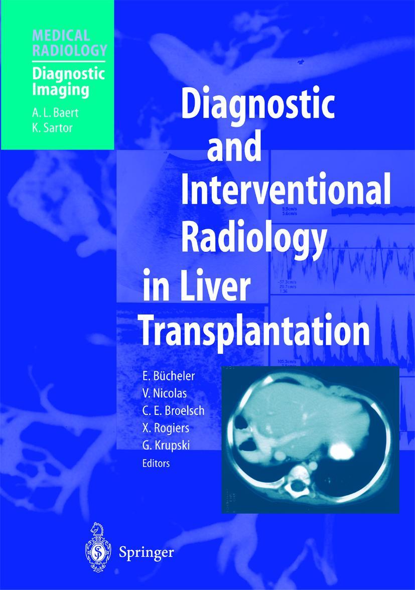 Vorderes Coverbild Diagnostic and Interventional Radiology in Liver Transplantation