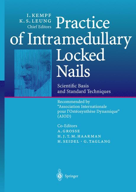 Vorderes Coverbild Practice of Intramedullary Locked Nails