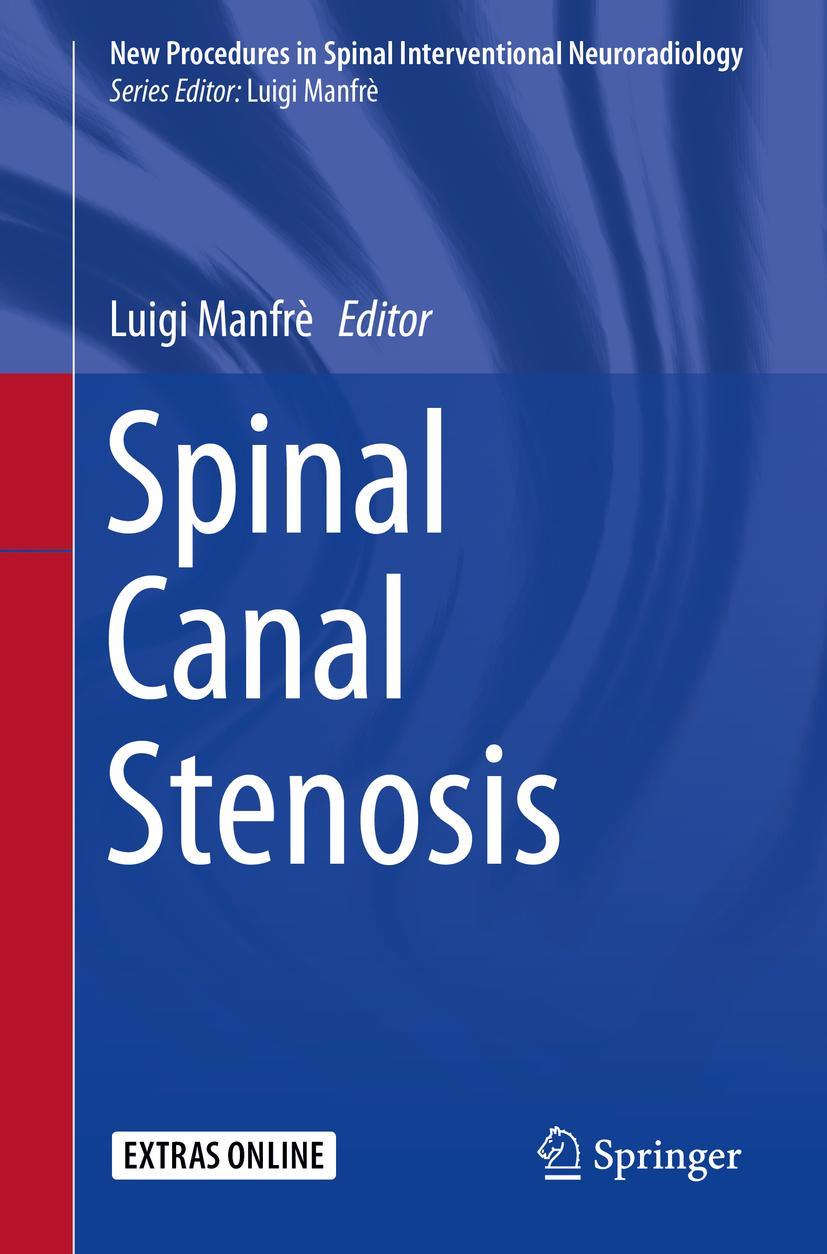 Vorderes Coverbild Spinal Canal Stenosis