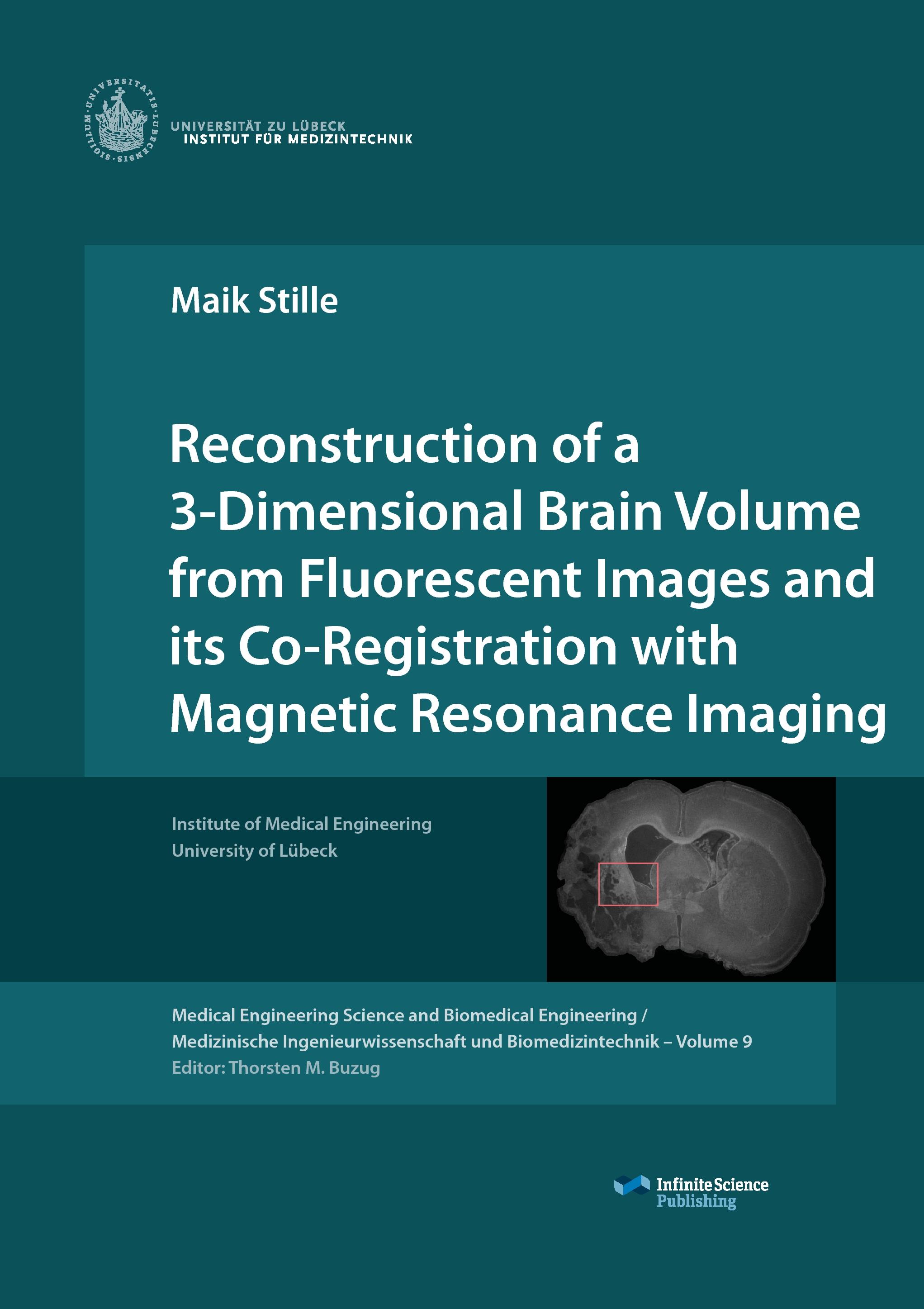 Vorderes Coverbild Reconstruction of a 3-Dimensional Brain Volume from Fluorescent Images and its Co-Registration with Magnetic Resonance Imaging