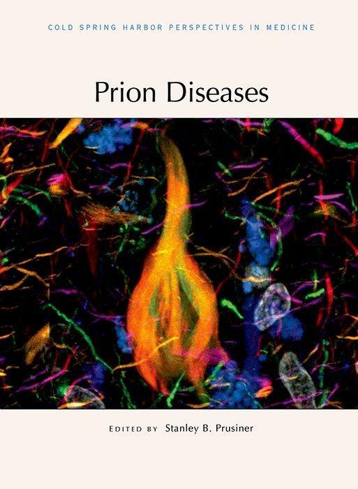 Vorderes Coverbild Prion Diseases