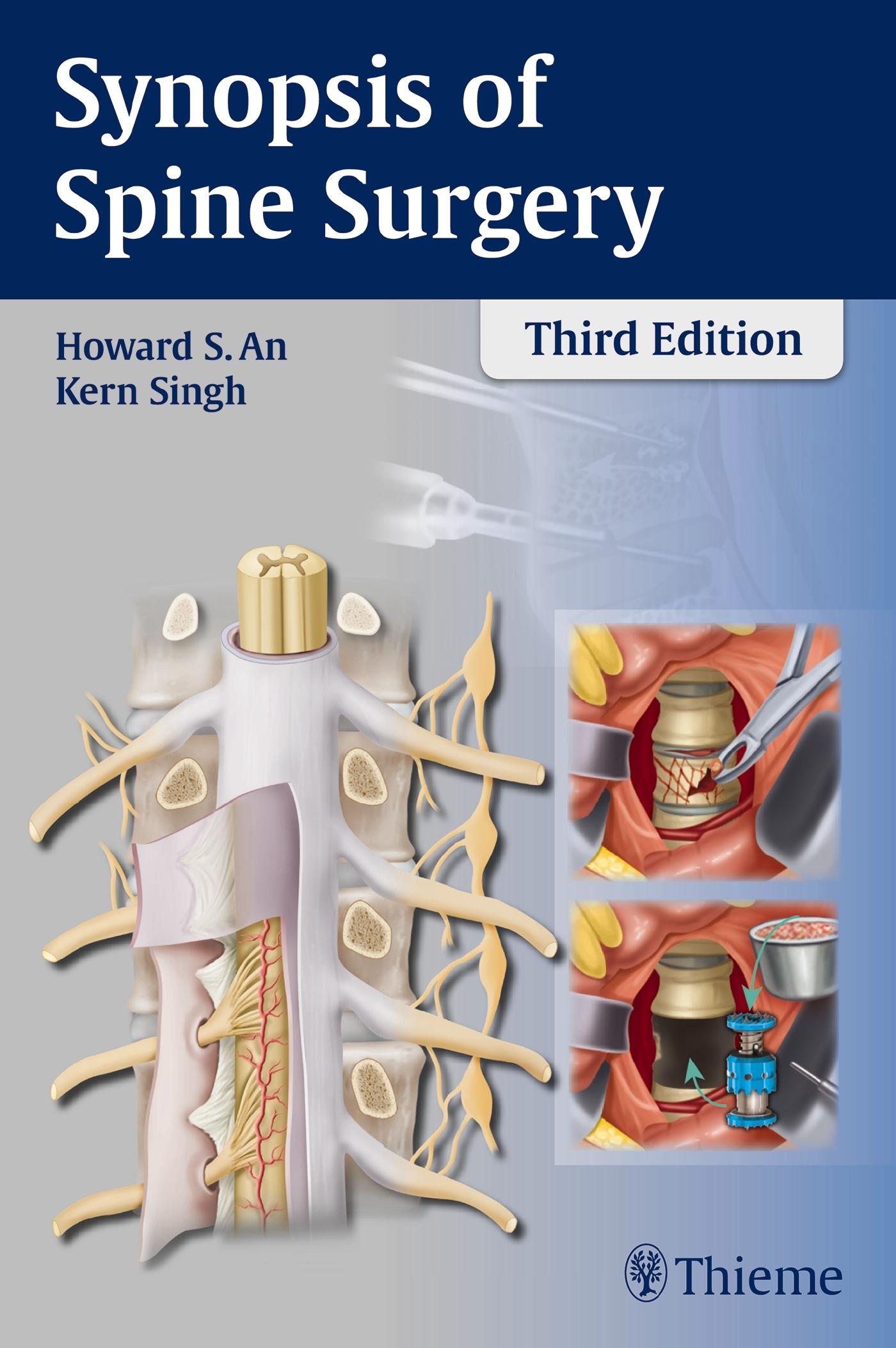 Vorderes Coverbild Synopsis of Spine Surgery
