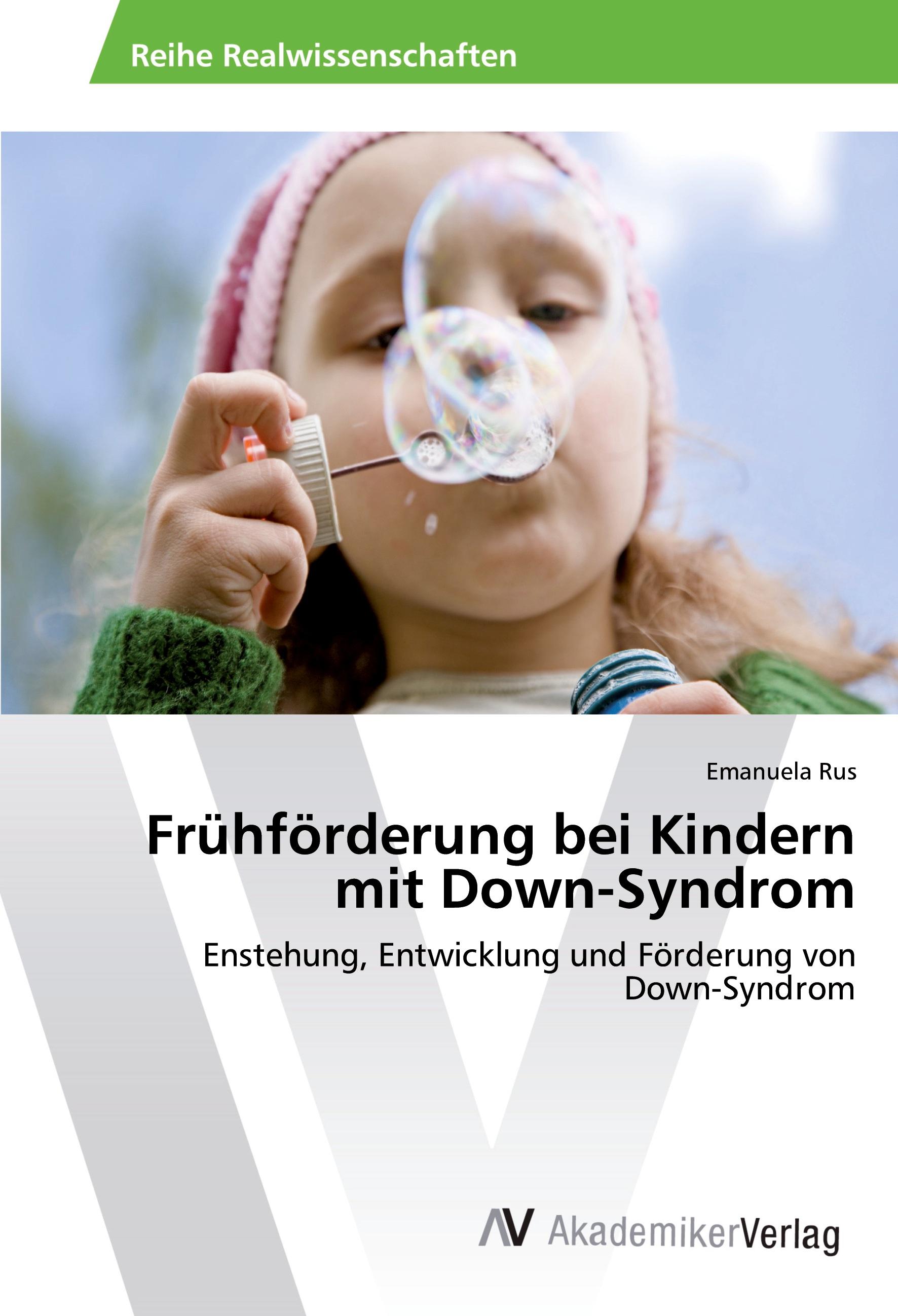 Vorderes Coverbild Frühförderung bei Kindern mit Down-Syndrom