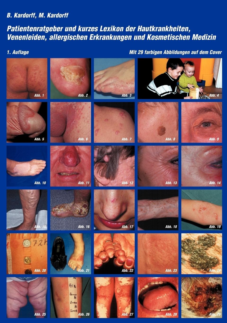 Vorderes Coverbild Patientenratgeber und kurzes Lexikon der Hautkrankheiten, Venenleiden, allergischen Erkrankungen und kosmetischen Medizin