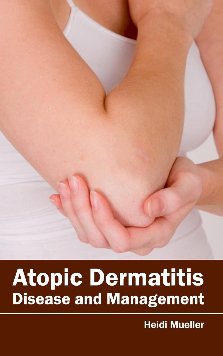 Vorderes Coverbild Atopic Dermatitis
