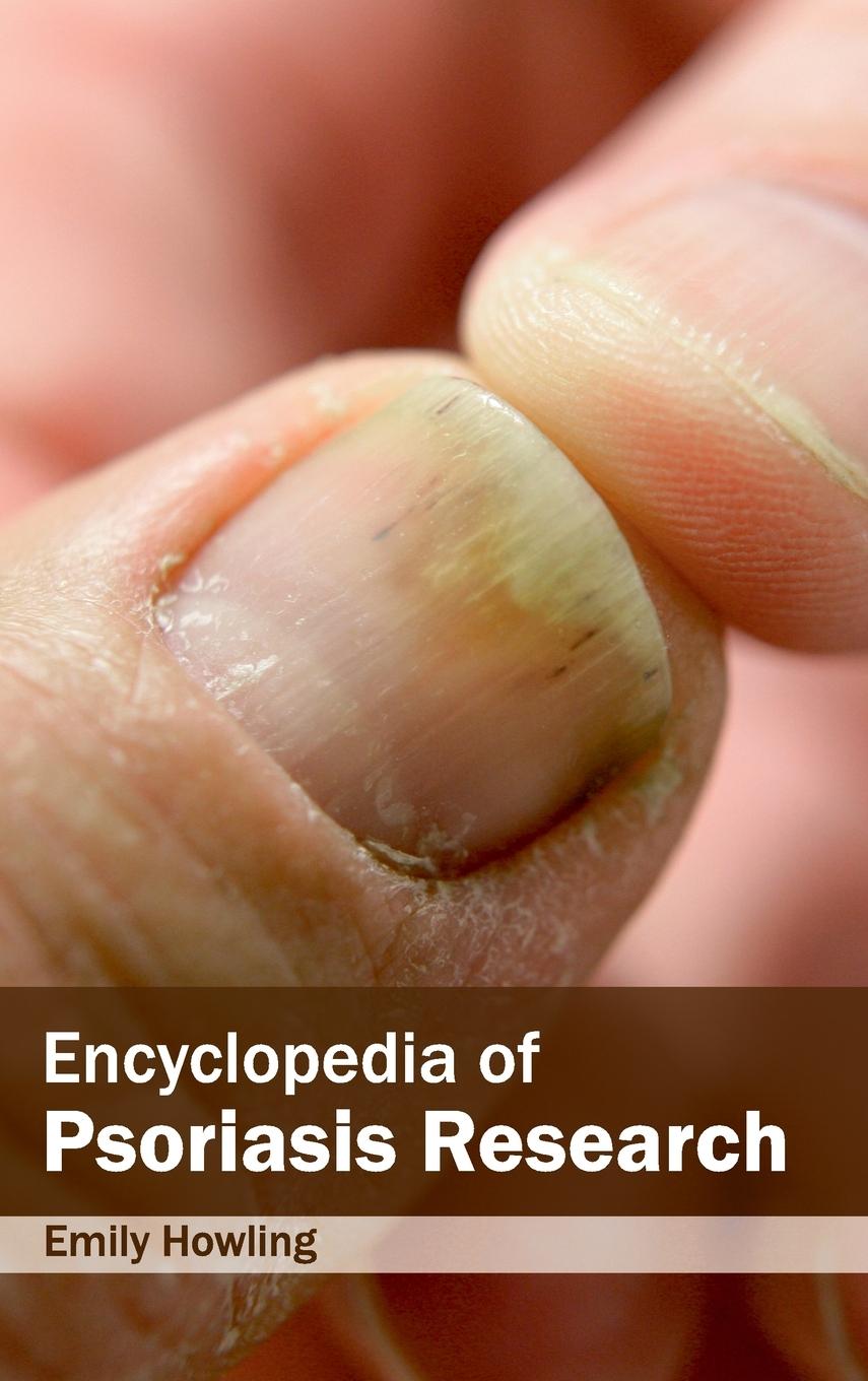 Vorderes Coverbild Encyclopedia of Psoriasis Research