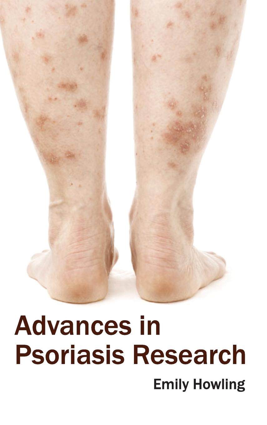 Vorderes Coverbild Advances in Psoriasis Research