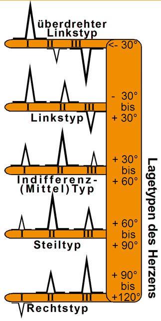 Autorenbild EKG Lineal professional II - 2015