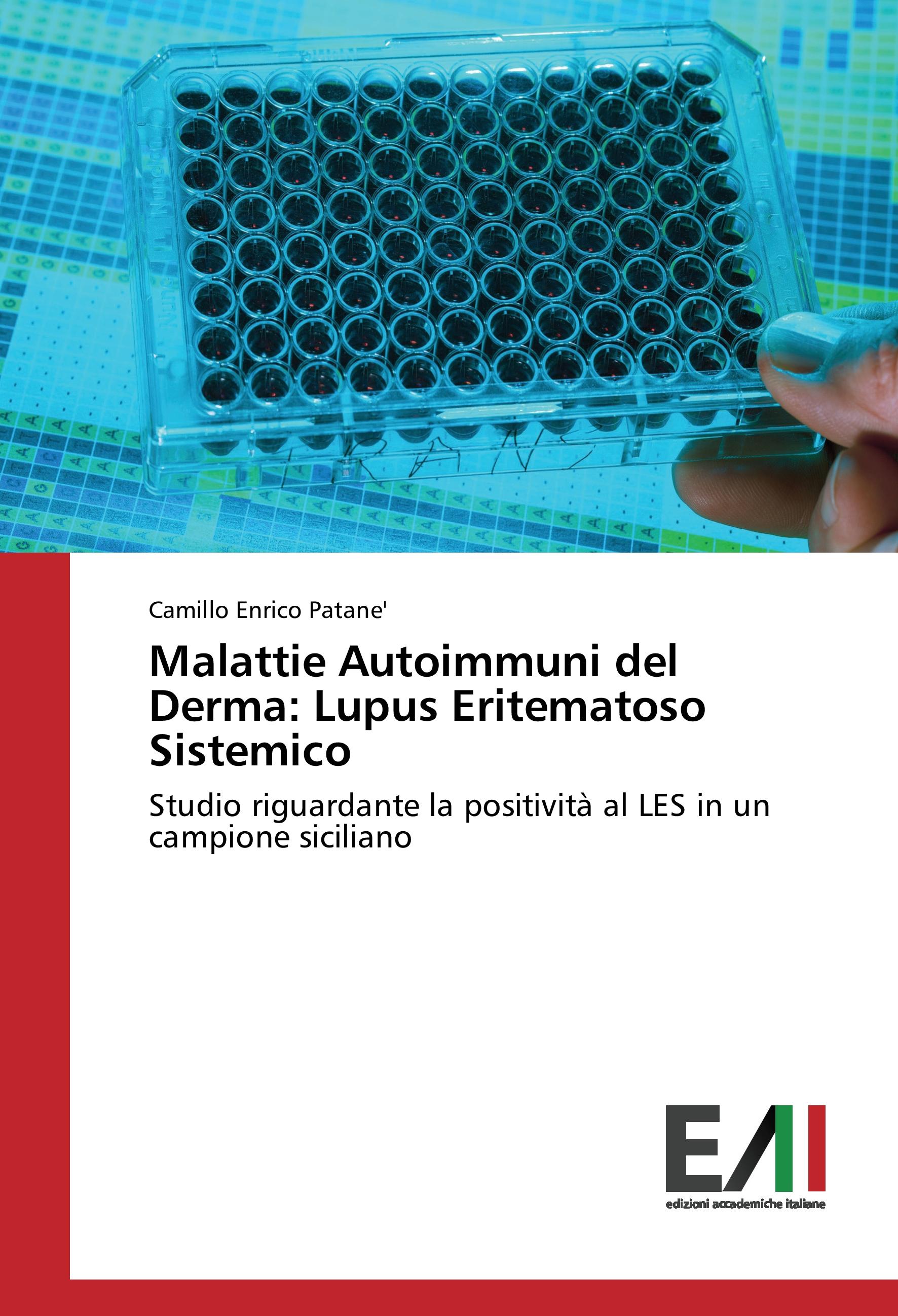 Vorderes Coverbild Malattie Autoimmuni del Derma: Lupus Eritematoso Sistemico