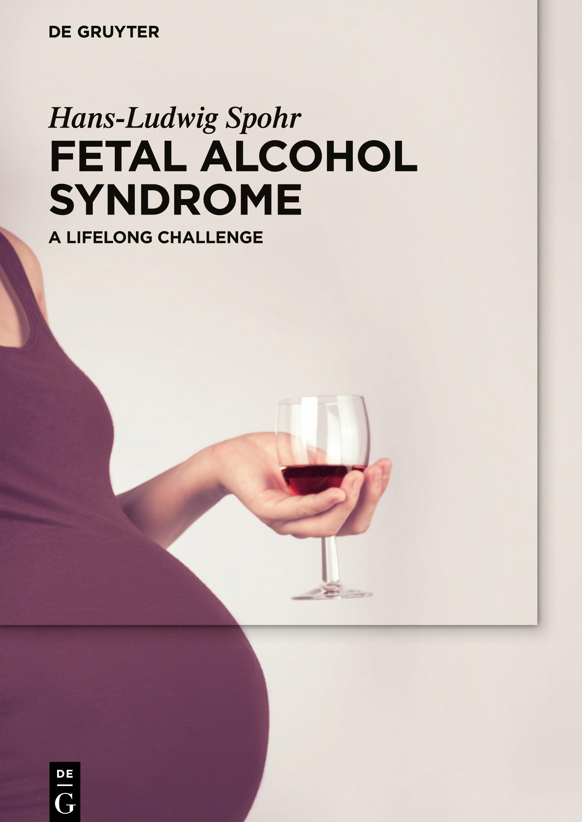 Vorderes Coverbild Fetal Alcohol Syndrome