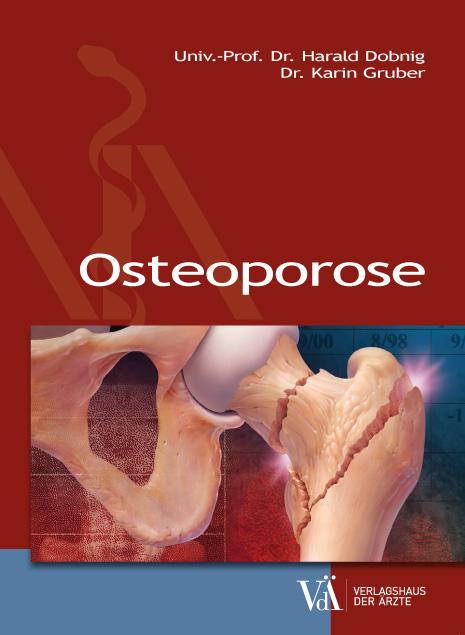 Vorderes Coverbild Osteoporose