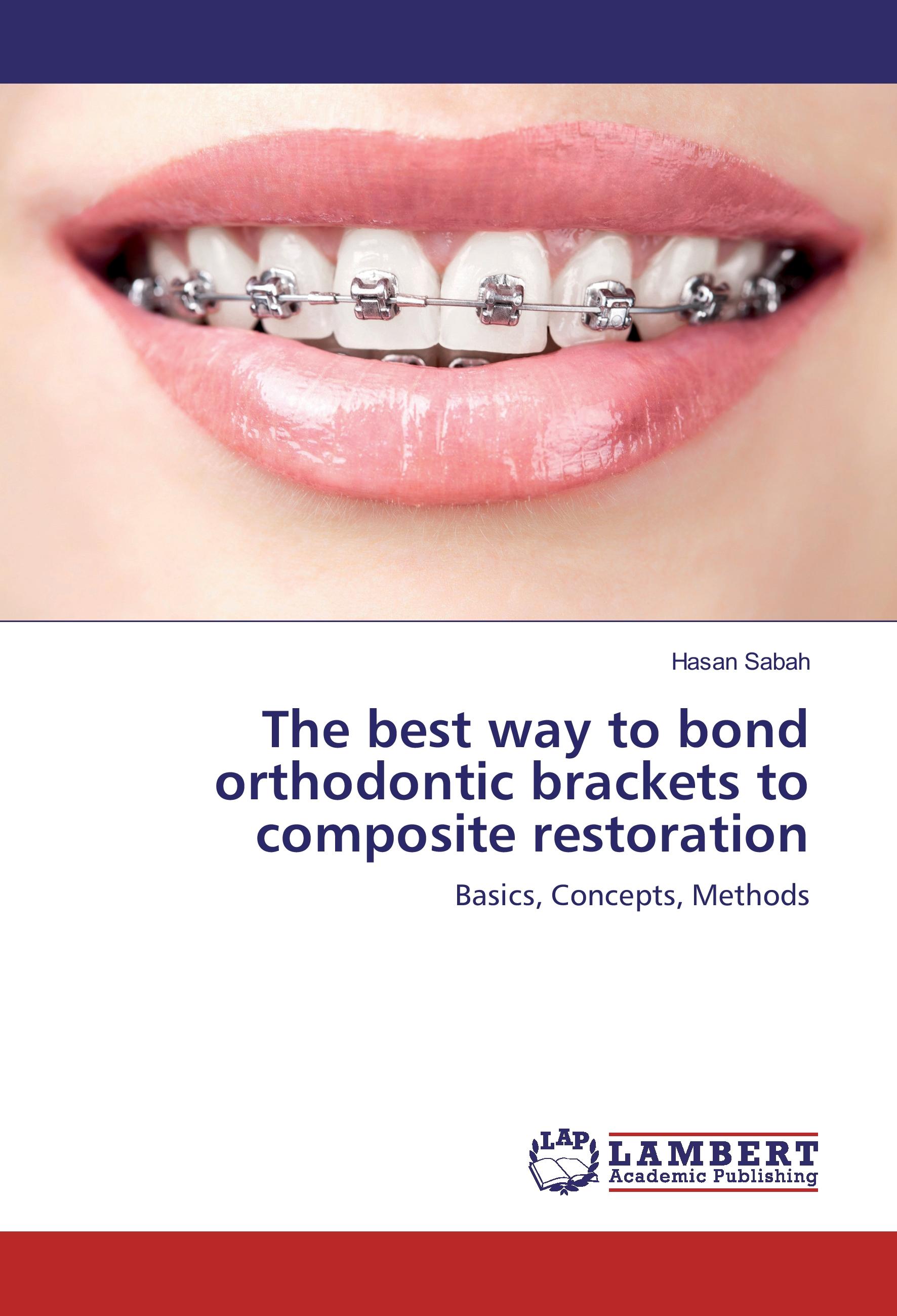 Vorderes Coverbild The best way to bond orthodontic brackets to composite restoration