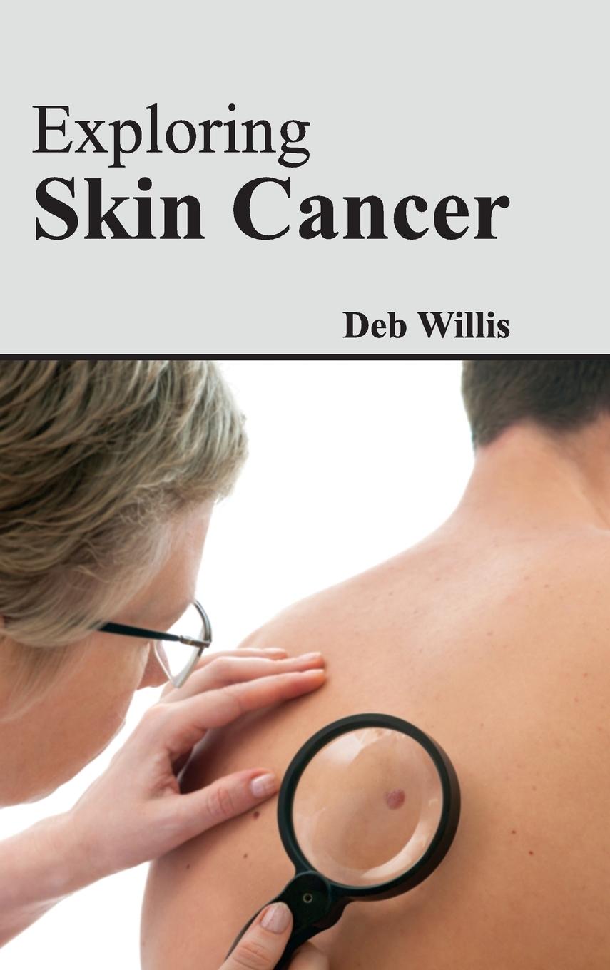Vorderes Coverbild Exploring Skin Cancer