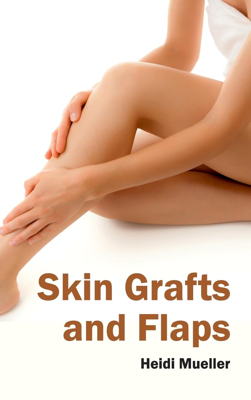 Vorderes Coverbild Skin Grafts and Flaps