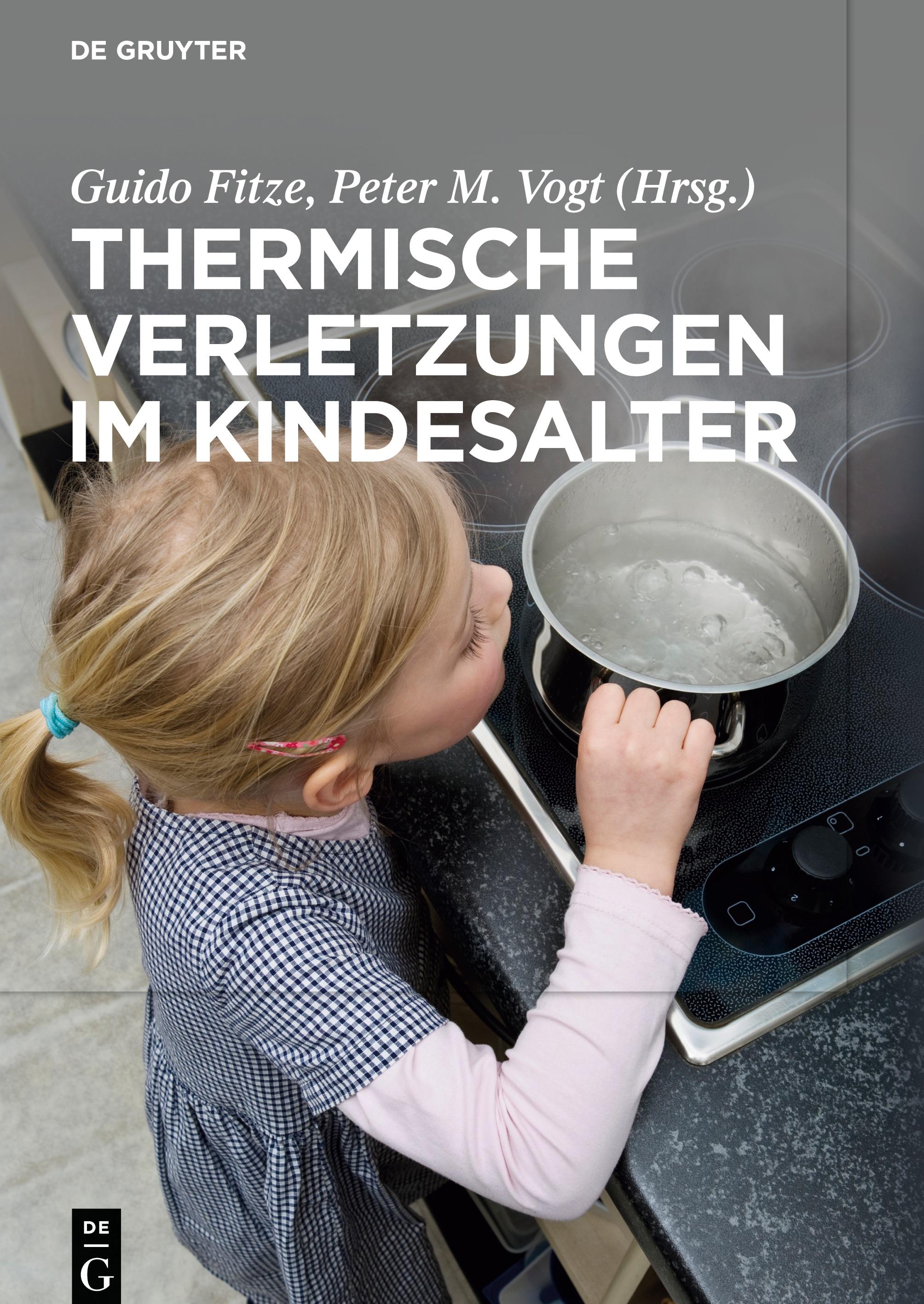Vorderes Coverbild Thermische Verletzungen im Kindesalter