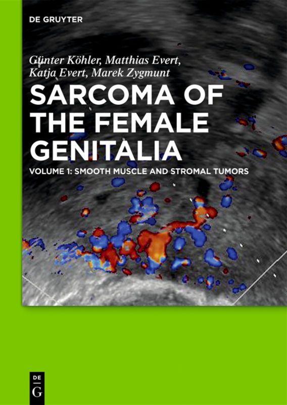 Vorderes Coverbild Smooth muscle and stromal tumors and prevention of inadequate surgery