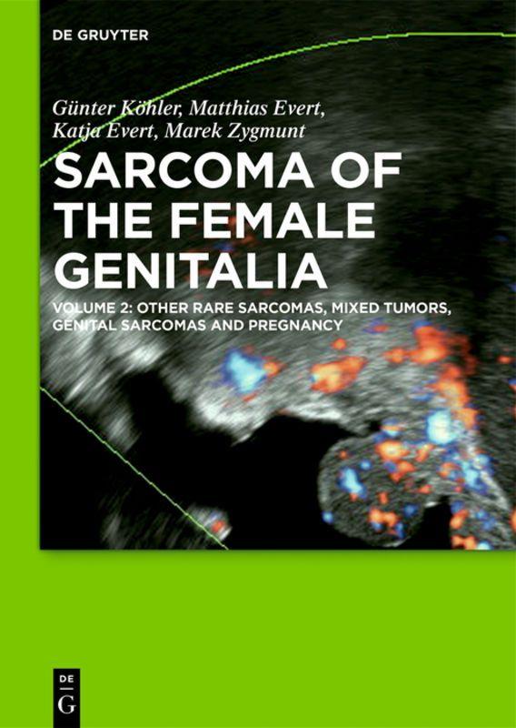 Vorderes Coverbild Other Rare Sarcomas, Mixed Tumors, Genital Sarcomas and Pregnancy