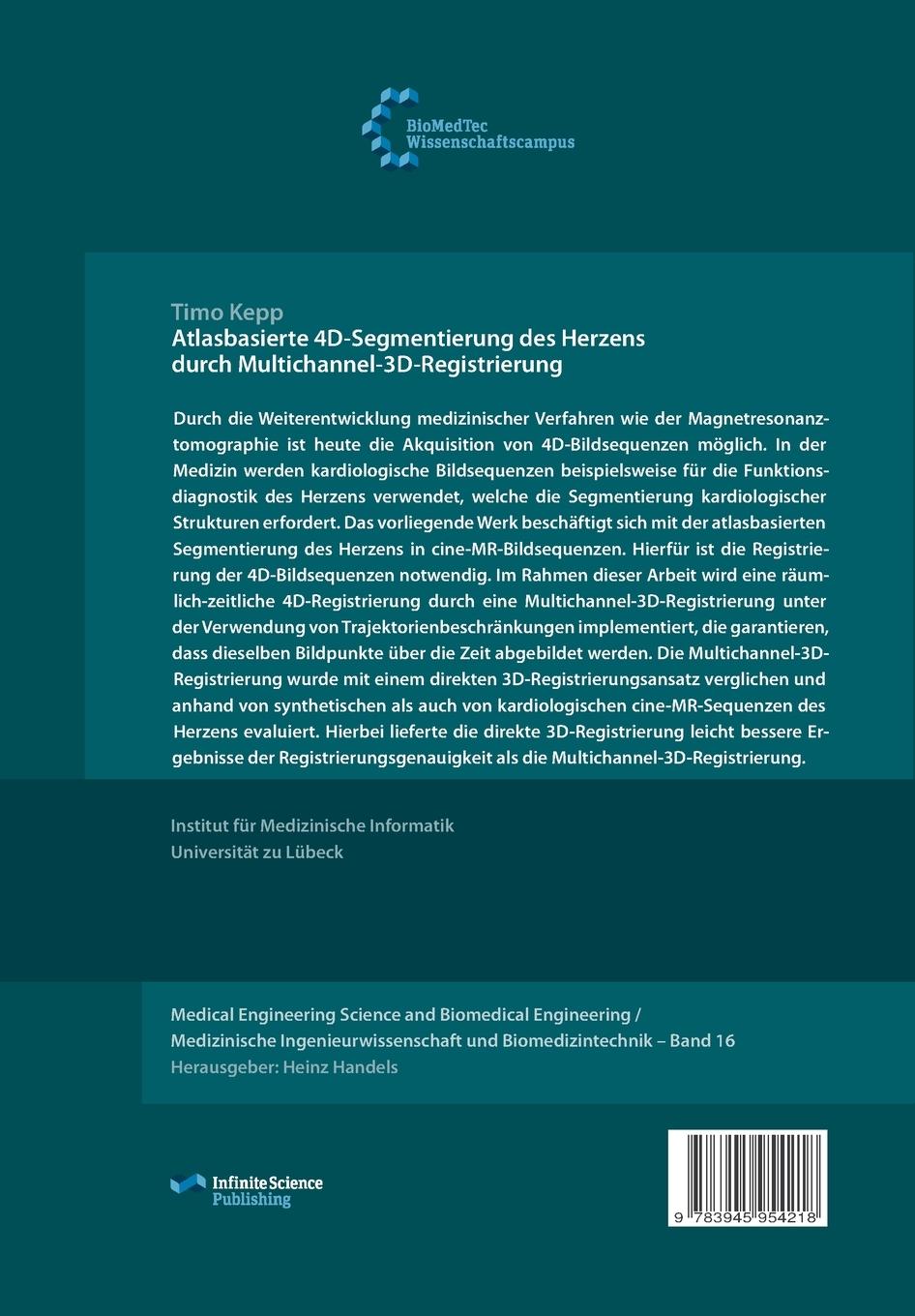 Rückseitencover Atlasbasierte 4D-Segmentierung des Herzens durch Multichannel 3D-Registrierung
