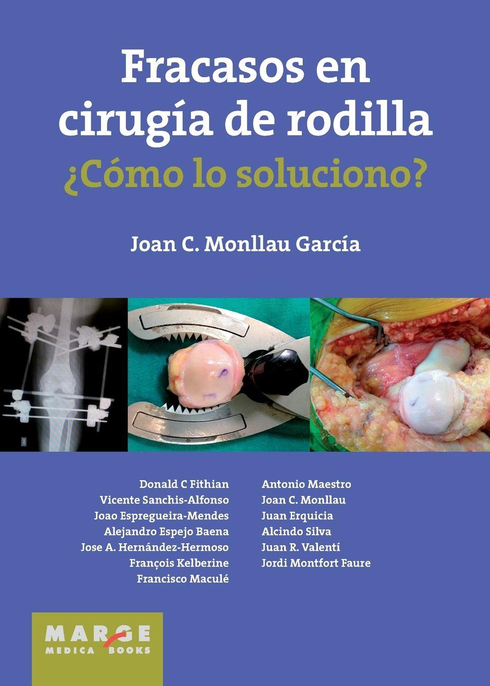 Vorderes Coverbild Fracasos en cirugía de rodilla ¿Cómo lo soluciono?