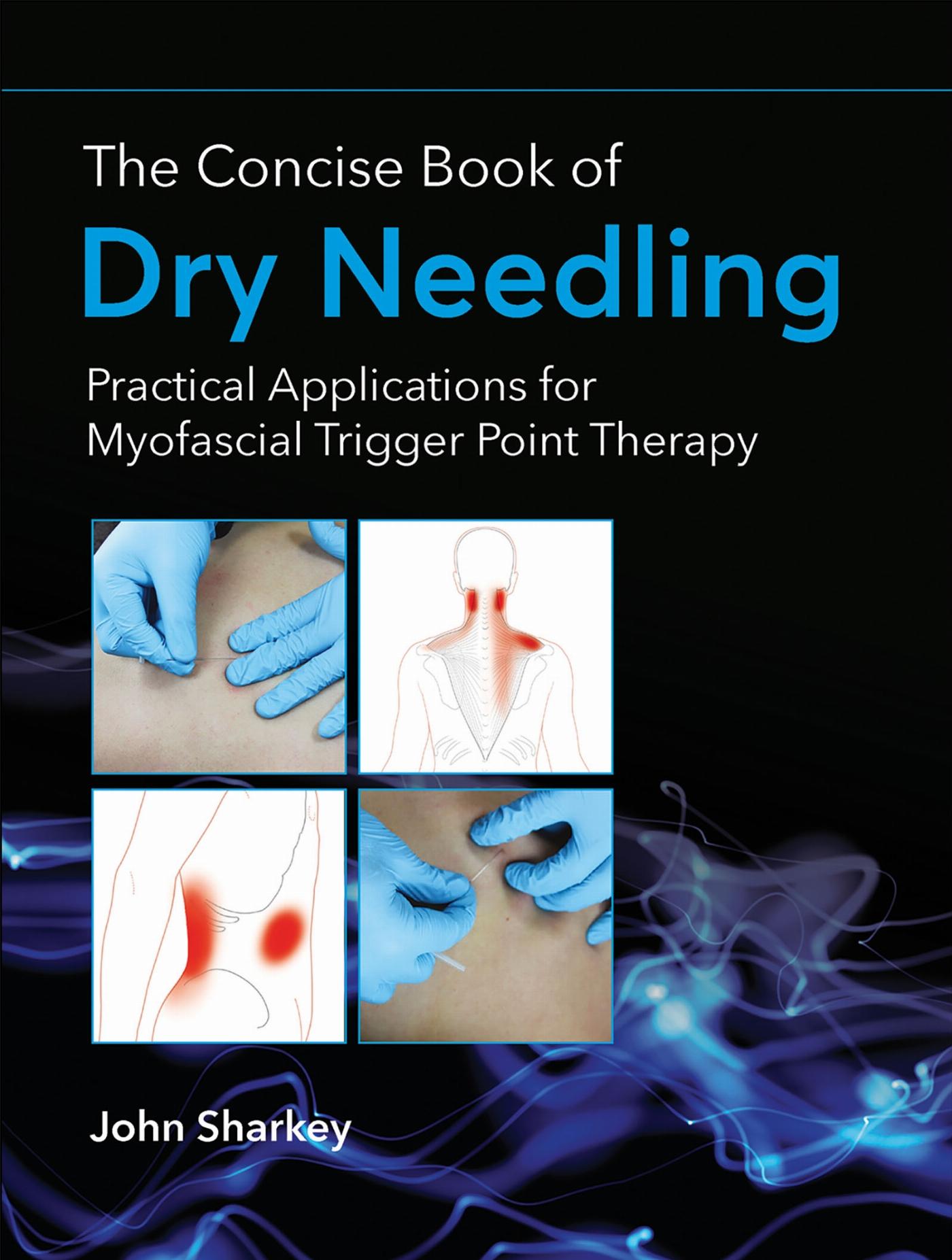 Vorderes Coverbild The Concise Book of Dry Needling