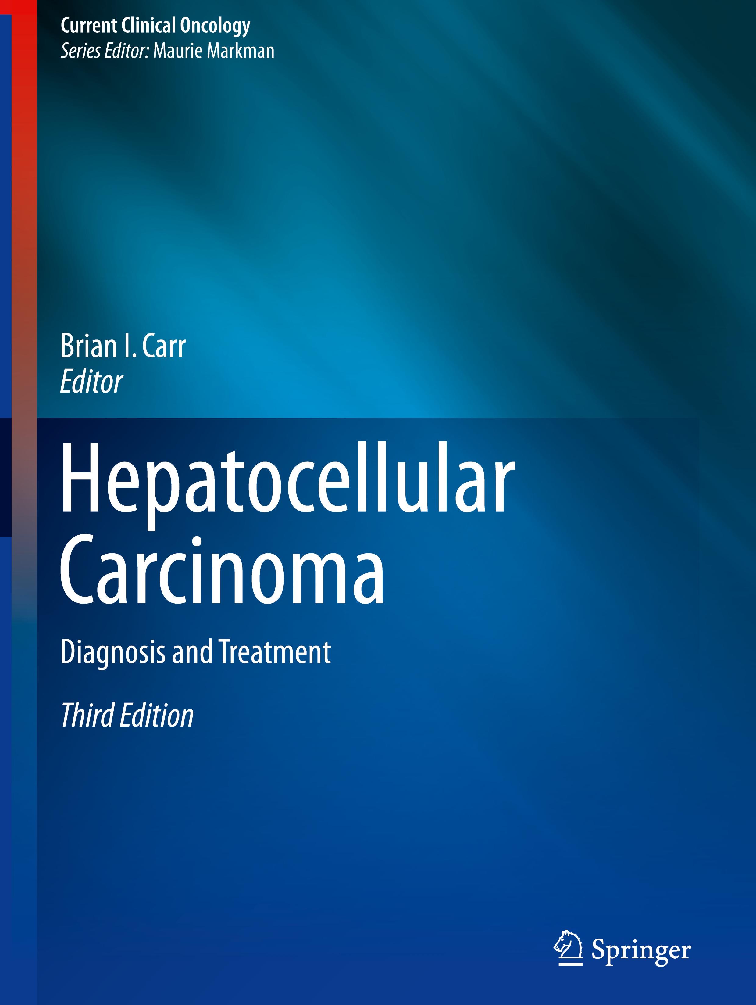 Vorderes Coverbild Hepatocellular Carcinoma