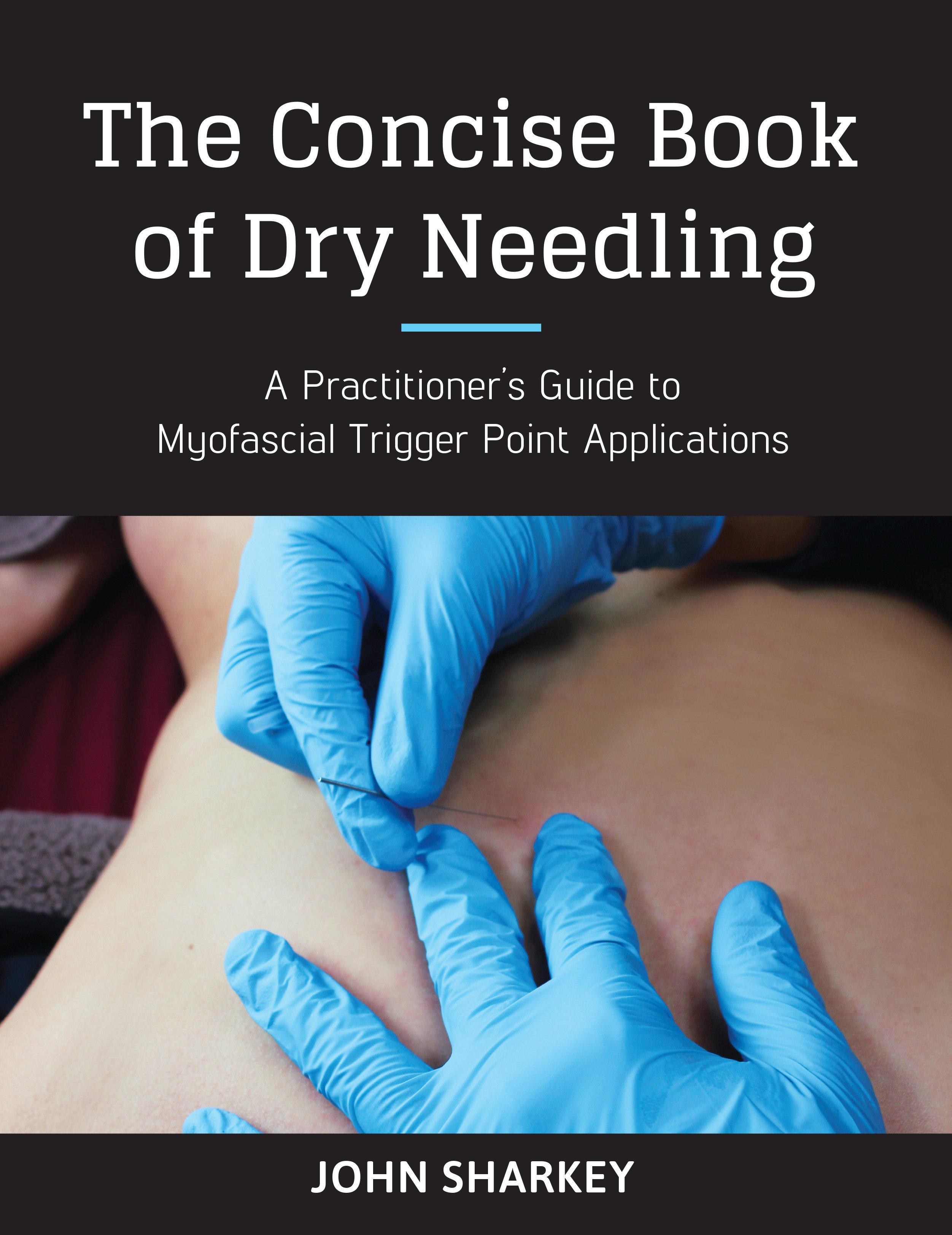 Vorderes Coverbild The Concise Book of Dry Needling