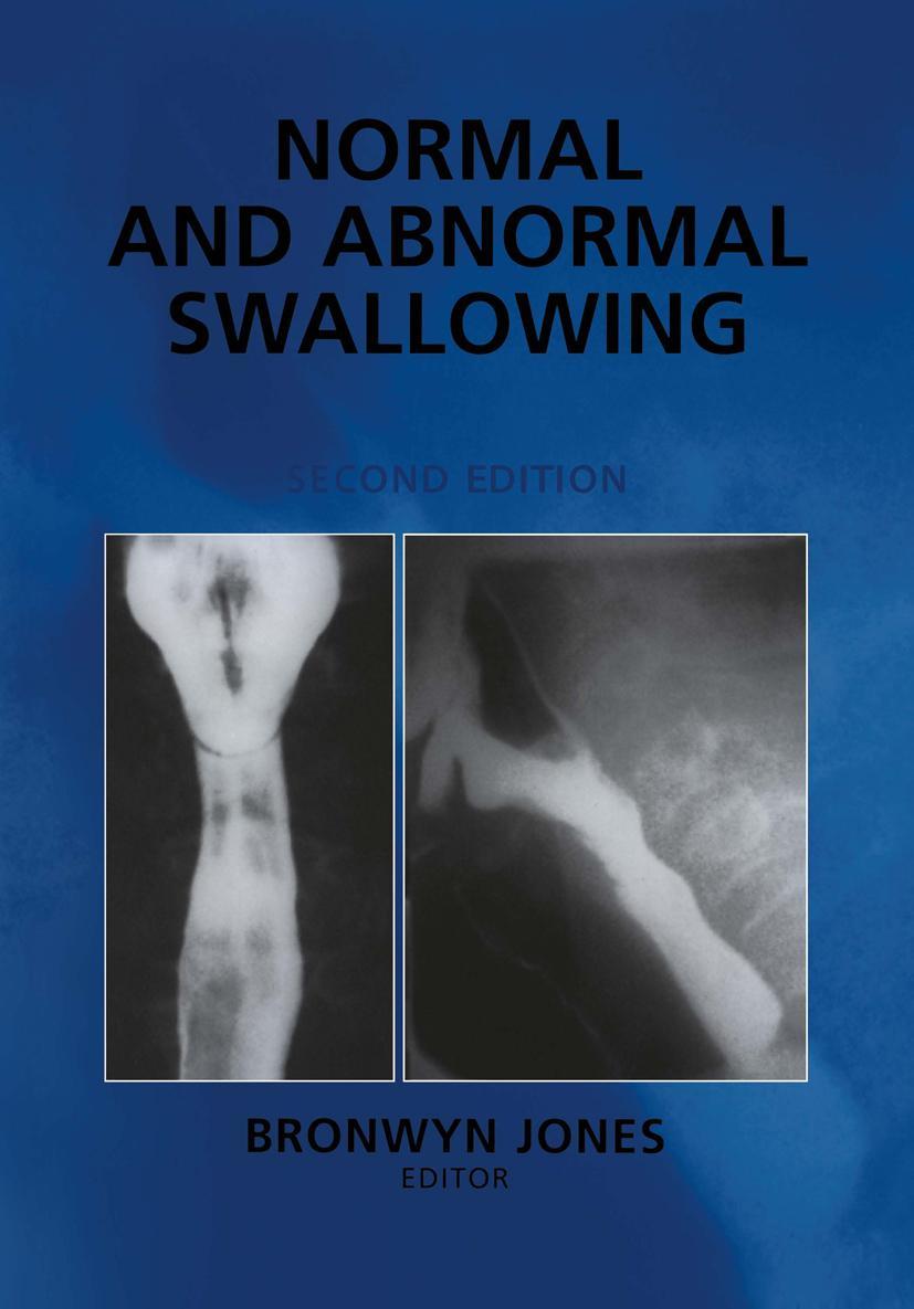 Vorderes Coverbild Normal and Abnormal Swallowing