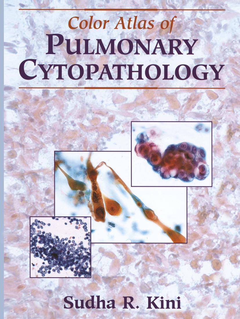 Vorderes Coverbild Color Atlas of Pulmonary Cytopathology