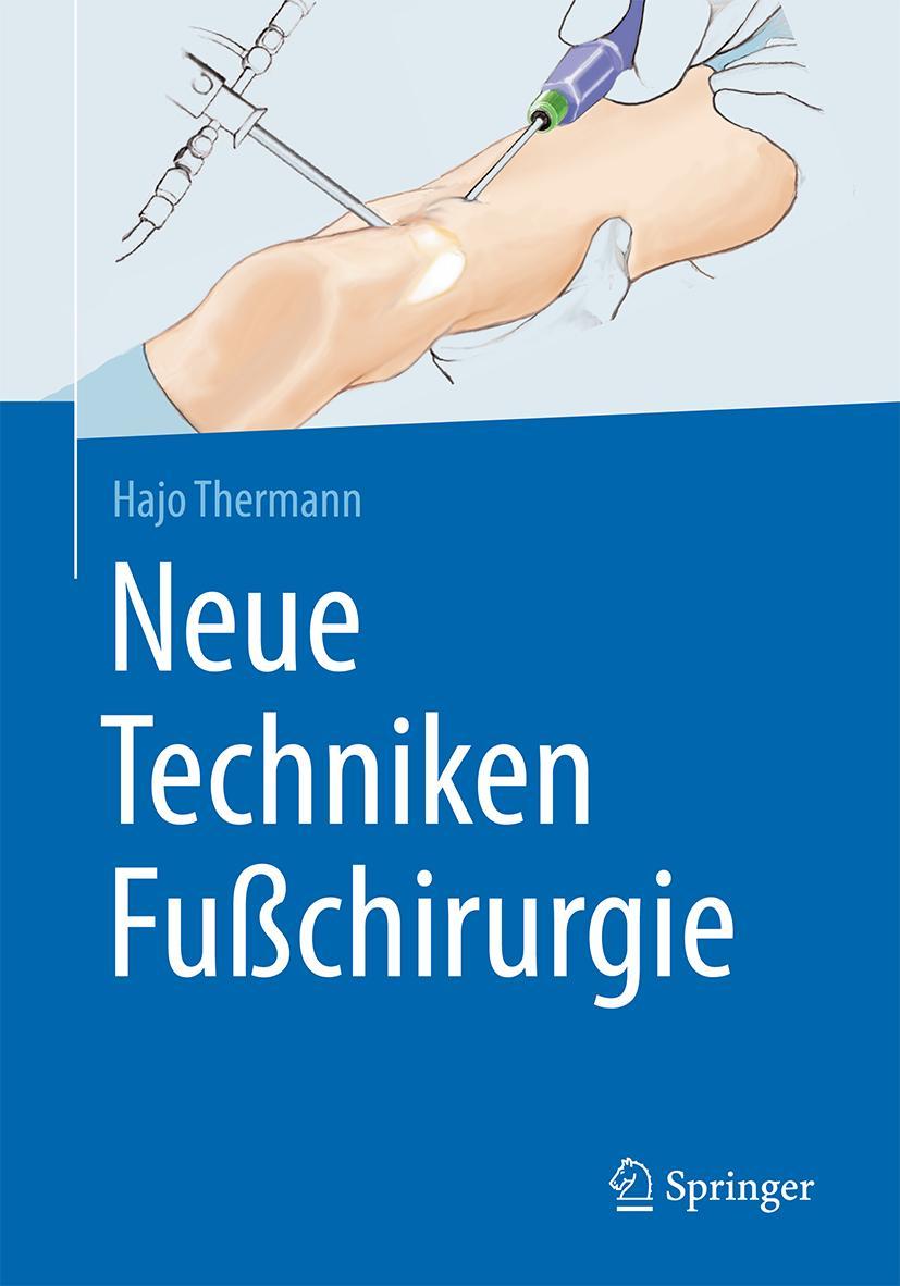 Vorderes Coverbild Neue Techniken Fußchirurgie