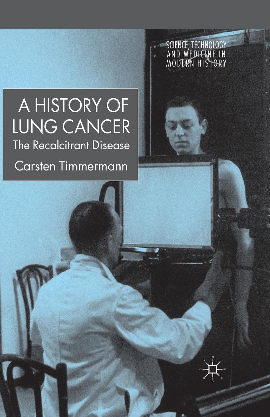 Vorderes Coverbild A History of Lung Cancer