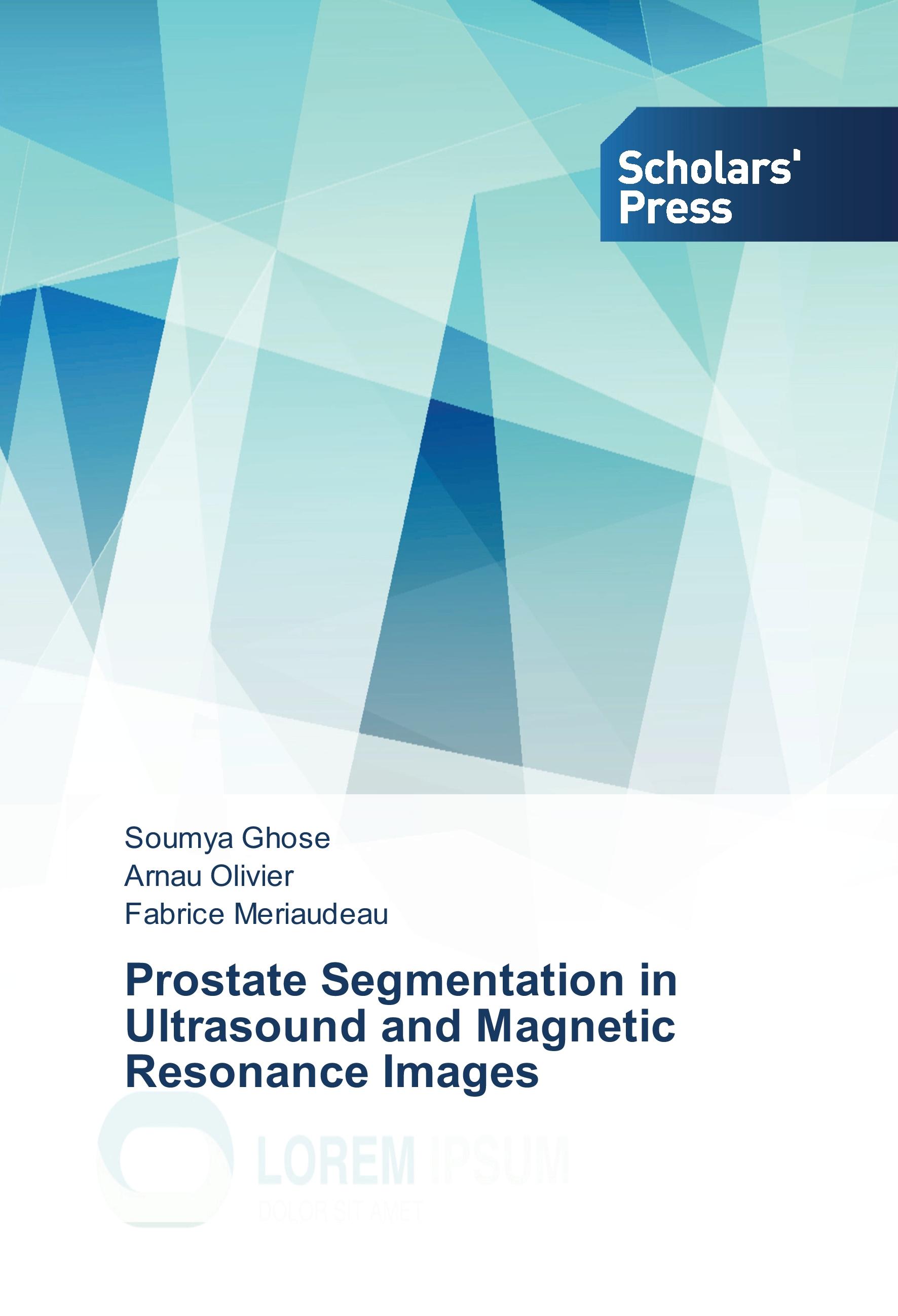 Vorderes Coverbild Prostate Segmentation in Ultrasound and Magnetic Resonance Images