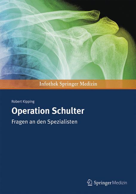 Vorderes Coverbild Operation Schulter