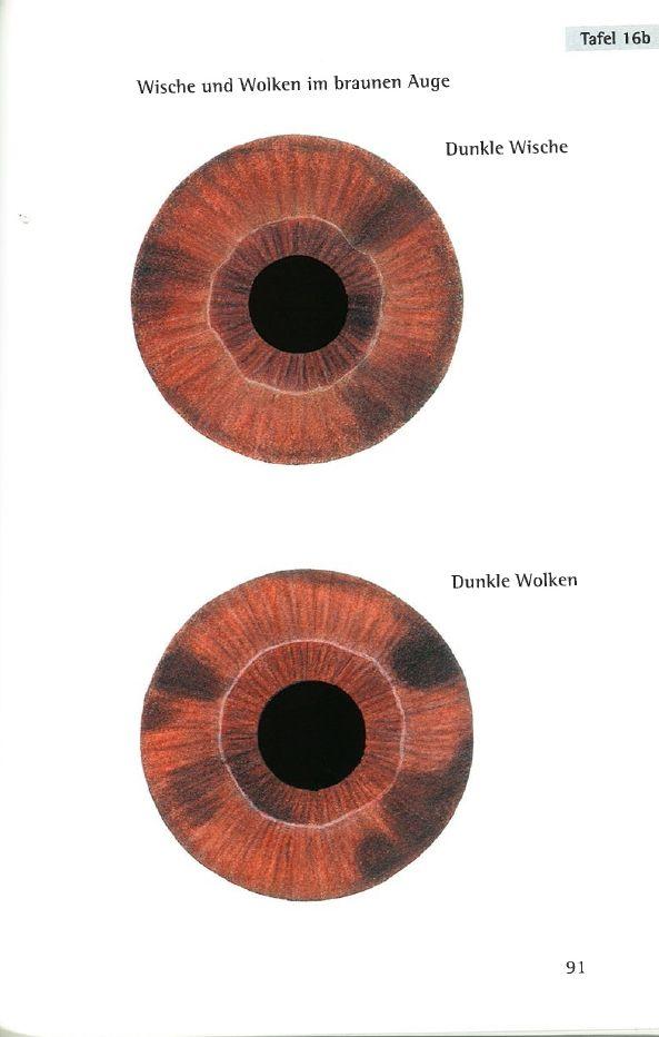 Beispielinhalt (Bild) Repertorium der Irisdiagnose