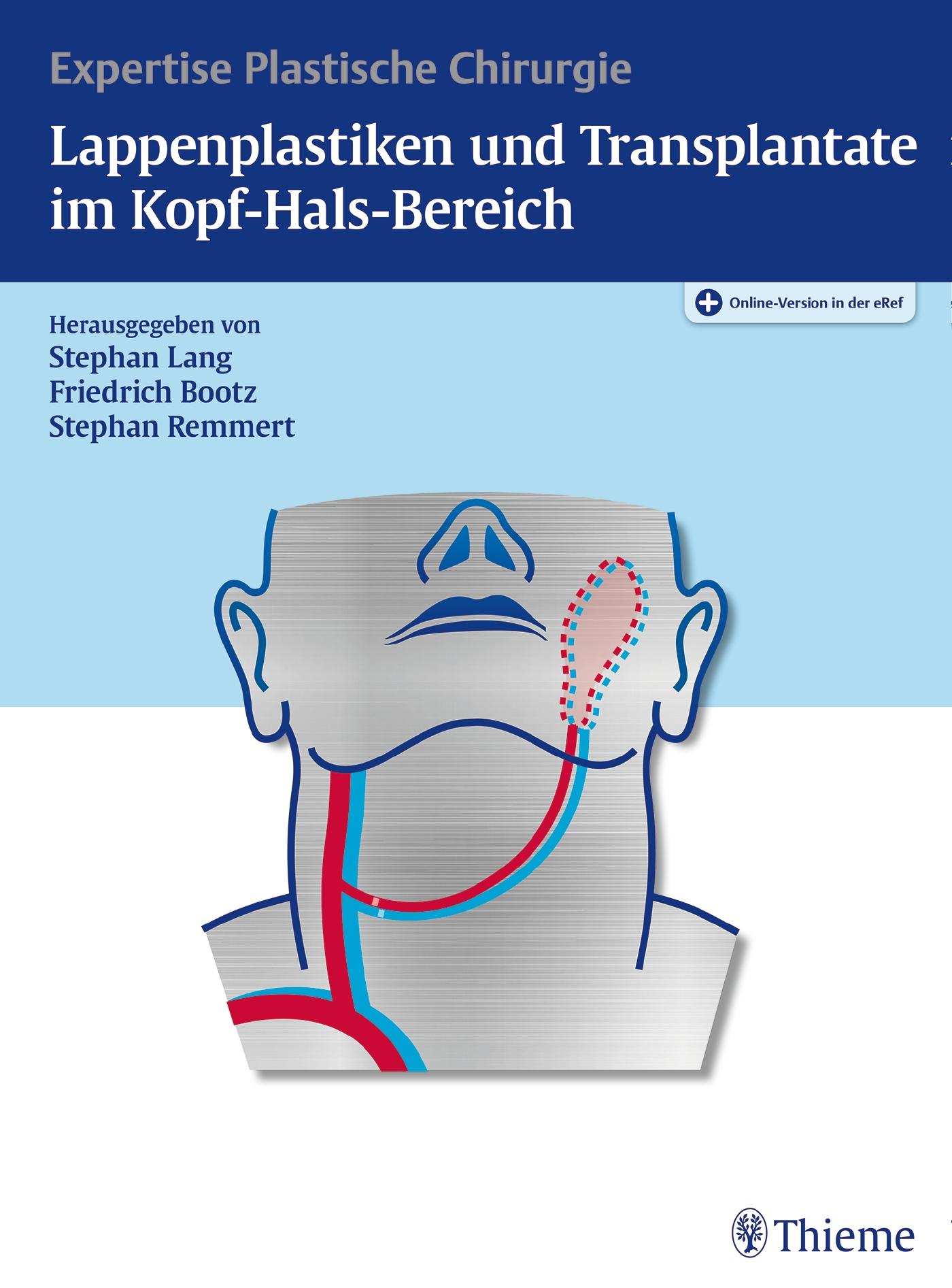 Vorderes Coverbild Lappenplastiken und Transplantate im Kopf-Hals-Bereich