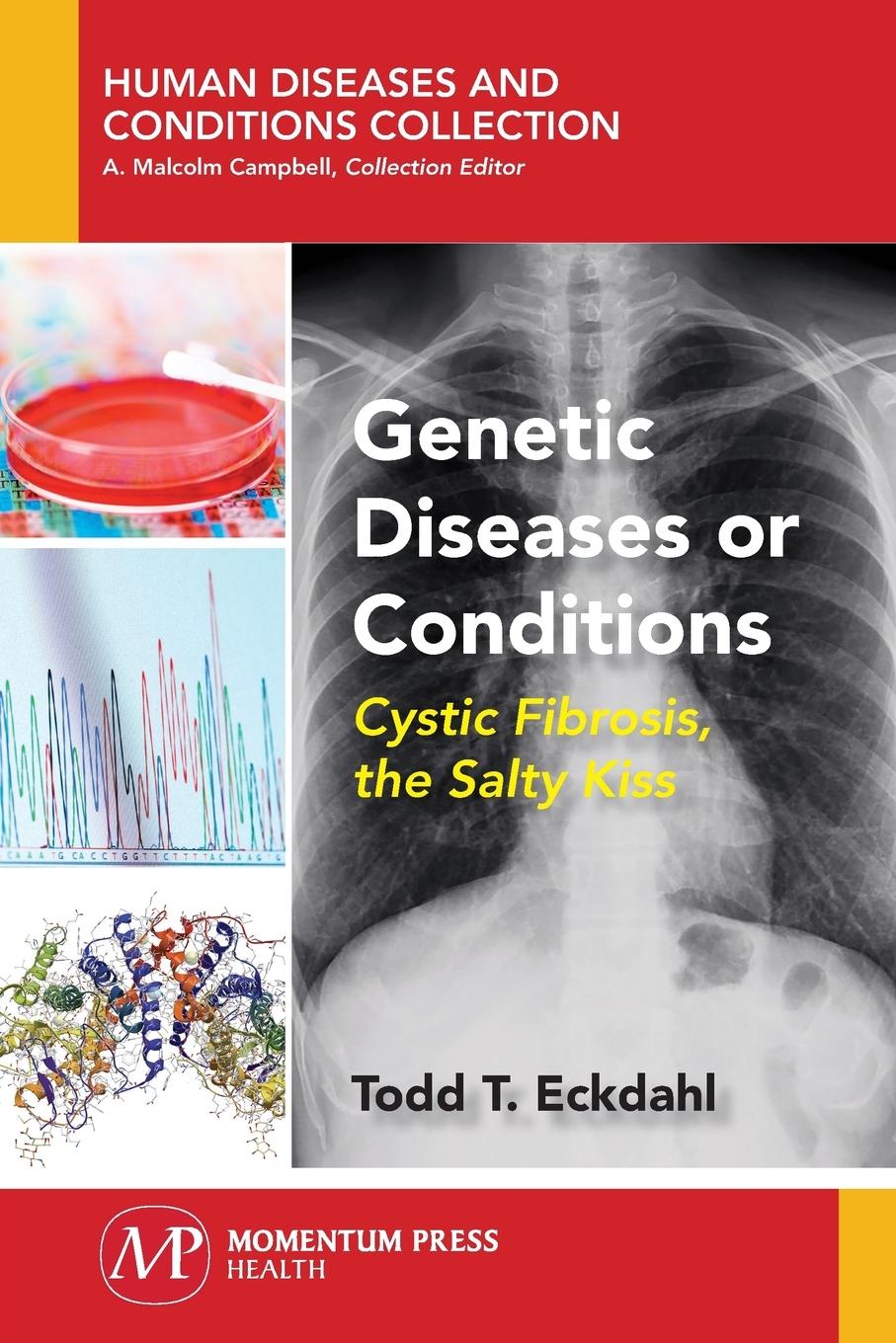Vorderes Coverbild Genetic Diseases or Conditions