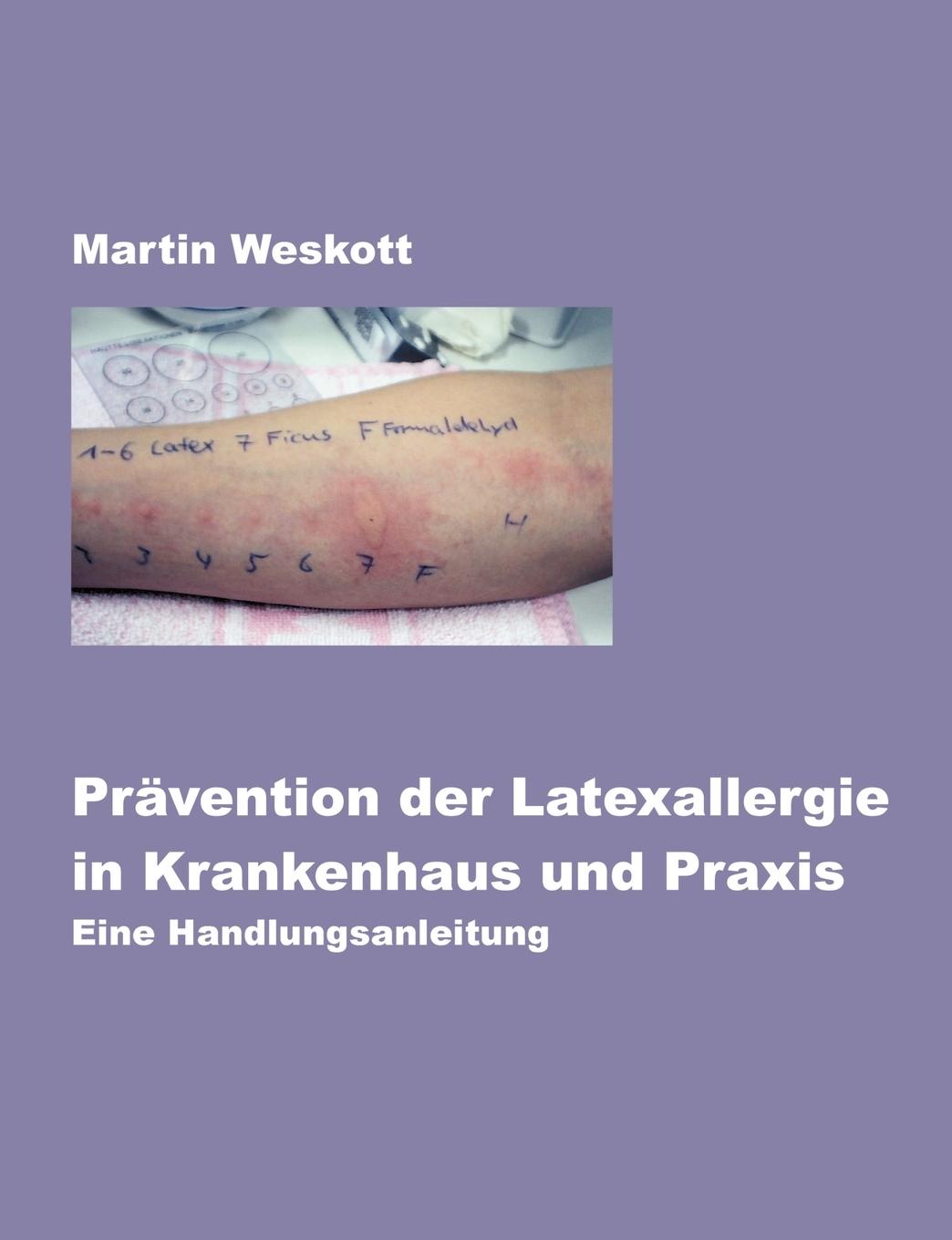Vorderes Coverbild Prävention der Latexallergie in Krankenhaus und Praxis