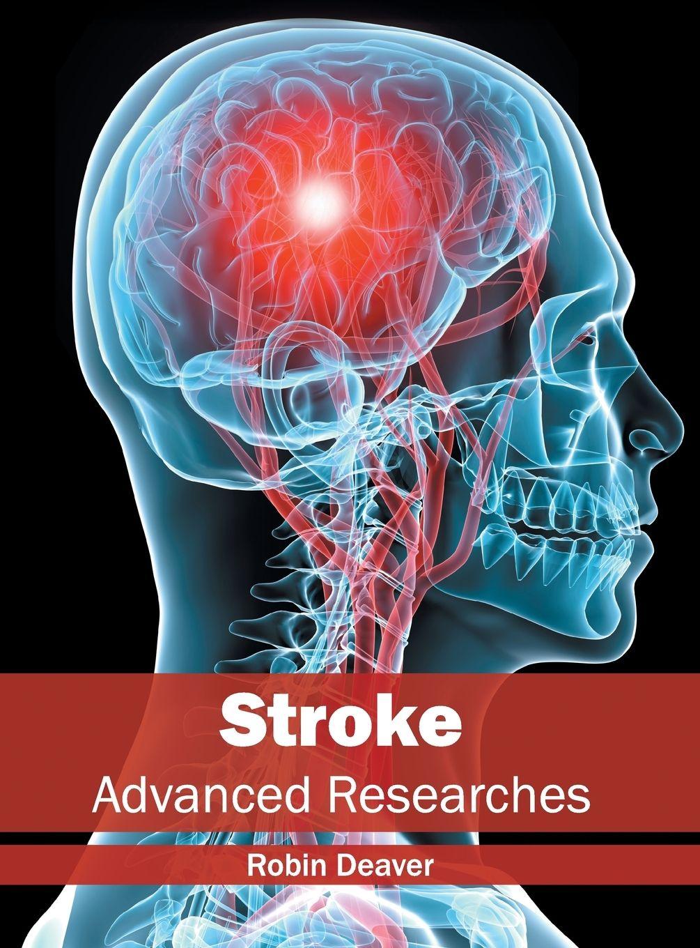 Vorderes Coverbild Stroke
