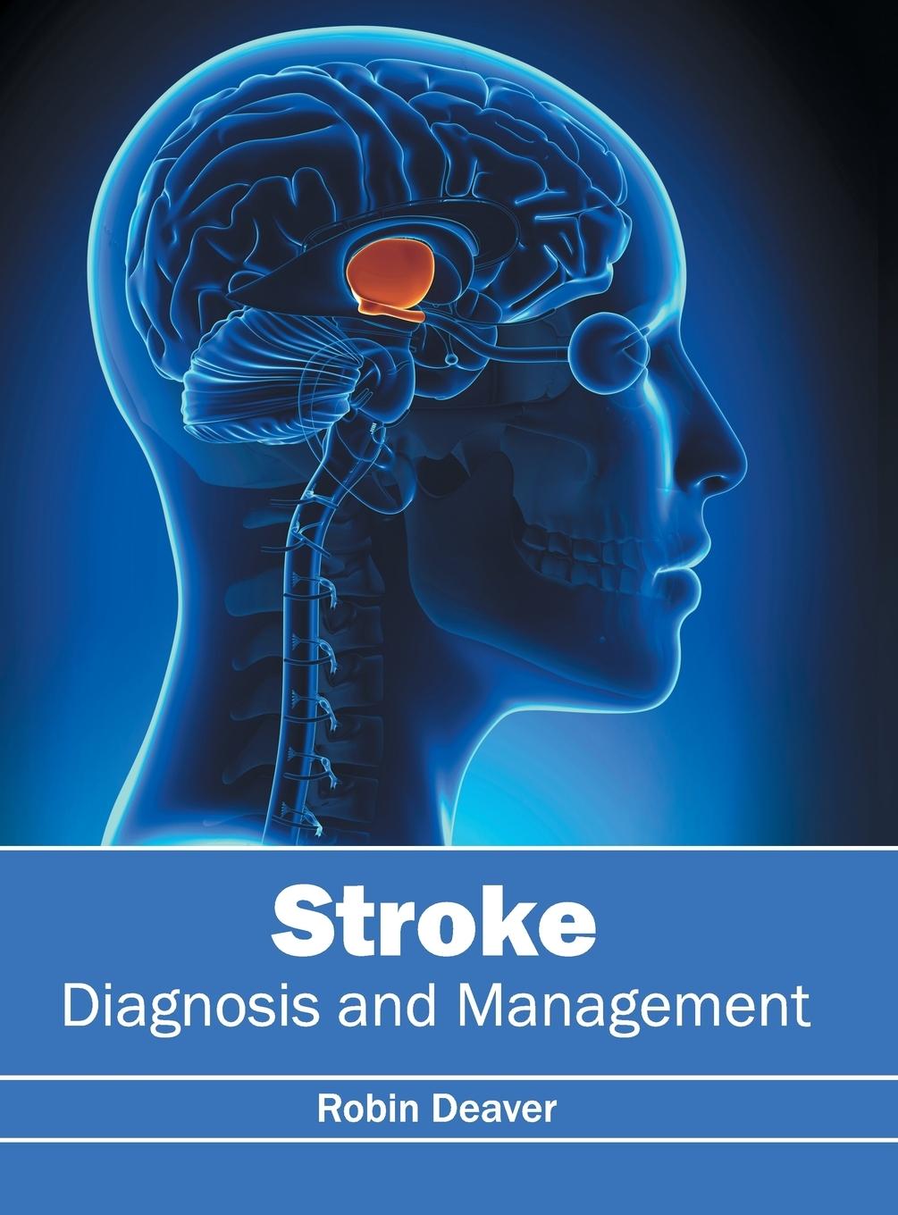 Vorderes Coverbild Stroke